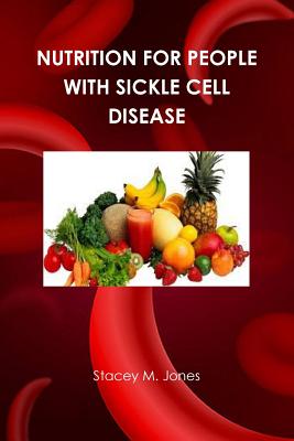 Nutrition for people with Sickle Cell Disease - Jones, Stacey