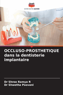 OCCLUSO-PROSTHETIQUE dans la dentisterie implantaire