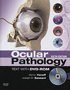 Ocular Pathology