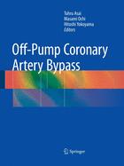 Off Pump Coronary Artery Bypass