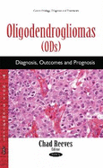 Oligodendrogliomas (ODs): Diagnosis, Outcomes & Prognosis