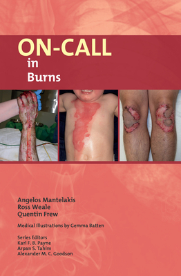 On-Call in Burns - Mantelakis, Angelos, and Weale, Ross, and Frew, Quentin