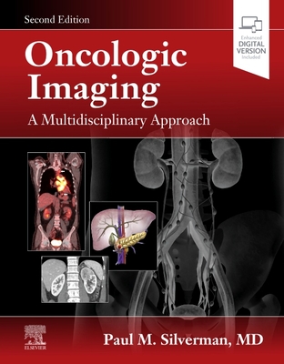 Oncologic Imaging: A Multidisciplinary Approach - Silverman, Paul M, MD (Editor)