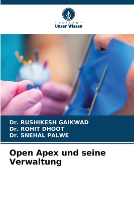 Open Apex und seine Verwaltung - Gaikwad, Rushikesh, Dr., and Dhoot, Rohit, Dr., and Palwe, Snehal, Dr.