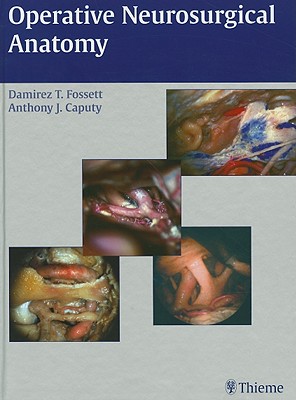 Operative Neurosurgical Anatomy - Fossett, Damirez T, and Caputy, Anthony J