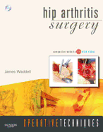 Operative Techniques: Hip Arthritis Surgery: Book, Website and DVD
