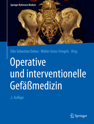 Operative Und Interventionelle Gef??medizin - Debus, Eike Sebastian (Editor), and Gross-Fengels, Walter (Editor)