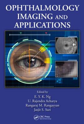 Ophthalmological Imaging and Applications - Ng, E. Y. K. (Editor), and Acharya, U. Rajendra (Editor), and Rangayyan, Rangaraj M. (Editor)