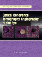 Optical Coherence Tomography Angiography of the Eye: Oct Angiography
