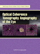 Optical Coherence Tomography Angiography of the Eye: OCT Angiography