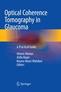 Optical Coherence Tomography in Glaucoma: A Practical Guide