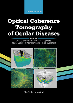 Optical Coherence Tomography of Ocular Diseases - Schuman, Joel S, MD, and Fujimoto, James G, PhD, and Duker, Jay
