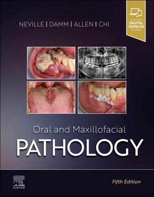 Oral and Maxillofacial Pathology - Neville, Brad W, Dds, and Damm, Douglas D, Dds, and Allen, Carl M, Dds