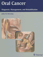 Oral Cancer: Diagnosis, Management, and Rehabilitation - Werning, John W (Editor)