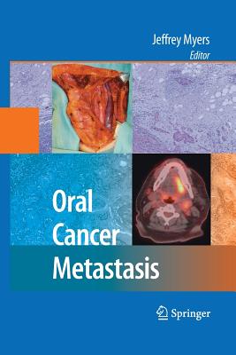 Oral Cancer Metastasis - Myers, Jeffrey (Editor)