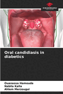 Oral candidiasis in diabetics