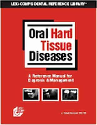 Oral Hard Tissue Diseases - Newland, J. Robert