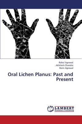 Oral Lichen Planus: Past and Present - Agrawal Rahul, and Chandra Akhilesh