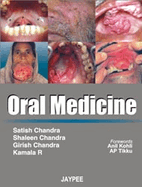 Oral Medicine