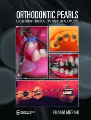 Orthodontic Pearls: A Selection of Practical Tips and Clinical Expertise - Mizrahi, Eliakim (Editor)