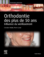 Orthodontie Des Plus de 50 ANS: Influence Du Vieillissement