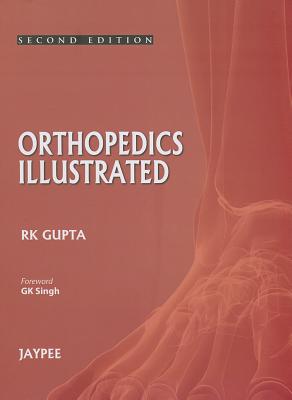 Orthopedics Illustrated - Gupta, R K