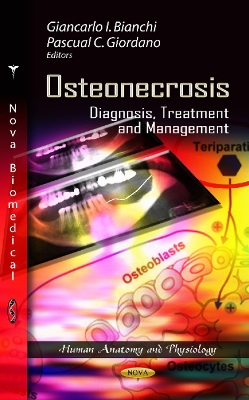 Osteonecrosis: Diagnosis, Treatment & Management - Bianchi, Giancarlo I (Editor), and Giordano, Pascual C (Editor)