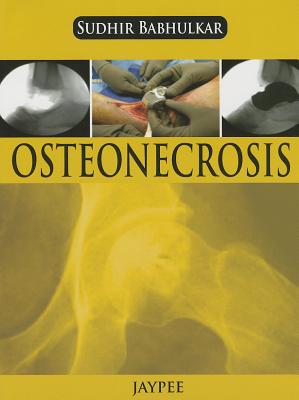 Osteonecrosis - Babhulkar, Sudhir