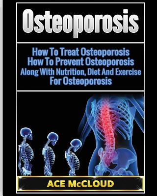 Osteoporosis: How To Treat Osteoporosis: How To Prevent Osteoporosis: Along With Nutrition, Diet And Exercise For Osteoporosis - McCloud, Ace