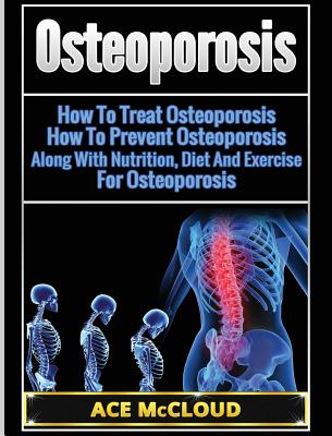 Osteoporosis: How To Treat Osteoporosis: How To Prevent Osteoporosis: Along With Nutrition, Diet And Exercise For Osteoporosis - McCloud, Ace