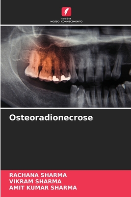 Osteoradionecrose - Sharma, Rachana, and Sharma, Vikram, and Sharma, Amit Kumar