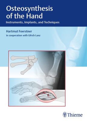 Osteosynthesis of the Hand: Instruments, Implants, and Techniques - Frstner, Hartmut