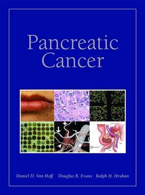 Pancreatic Cancer - Von Hoff, Daniel, and Evans, Douglas B, and Hruban, Ralph H