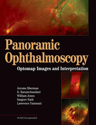 Panoramic Ophthalmoscopy: Optomap Images and Interpretation - Sherman, Jerry, and Karamchandani, Gulshan, Bs, and Jones, William