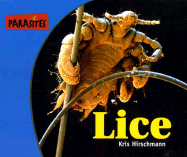 Parasites: Lice