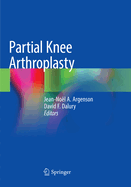 Partial Knee Arthroplasty