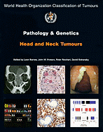 Pathology and Genetics of Head and Neck Tumours [Op]