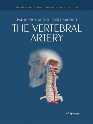 Pathology and Surgery Around the Vertebral Artery - George, Bernard (Editor), and Bruneau, Michal (Editor), and Spetzler, Robert F