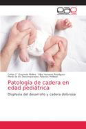 Patolog?a de cadera en edad peditrica