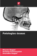 Patologias ?sseas