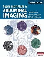 Pearls and Pitfalls in Abdominal Imaging: Pseudotumors, Variants and Other Difficult Diagnoses