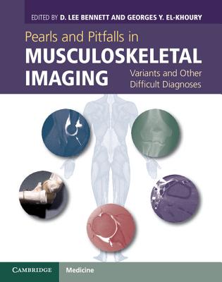 Pearls and Pitfalls in Musculoskeletal Imaging: Variants and Other Difficult Diagnoses - Bennett, D. Lee (Editor), and El-Khoury, Georges Y. (Editor)