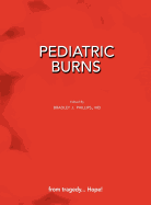 Pediatric Burns