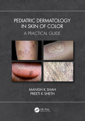 Pediatric Dermatology in Skin of Color: A Practical Guide - Shah, Manish K, and Sheth, Preeti K