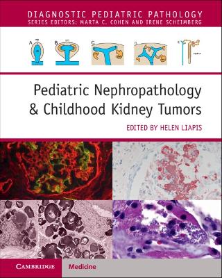 Pediatric Nephropathology & Childhood Kidney Tumors with Online Resource - Liapis, Helen (Editor)