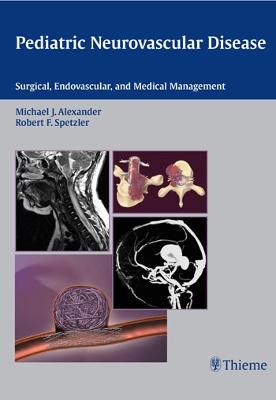 Pediatric Neurovascular Disease: Surgical, Endovascular and Medical Management - Alexander, Michael J (Editor), and Spetzler, Robert F (Editor)