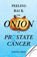 Peeling Back the Onion on Prostate Cancer