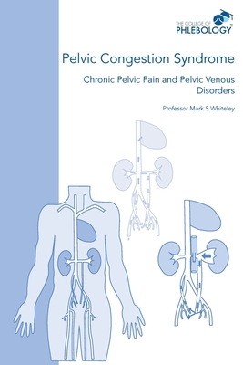 Pelvic Congestion Syndrome - Chronic Pelvic Pain and Pelvic Venous Disorders - Whiteley, Mark S