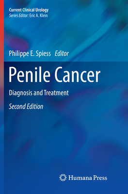 Penile Cancer: Diagnosis and Treatment - Spiess, Philippe E (Editor)