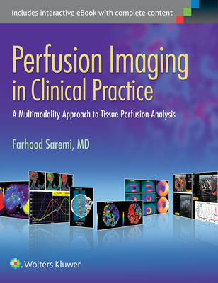 Perfusion Imaging in Clinical Practice: A Multimodality Approach to Tissue Perfusion Analysis - Saremi, Farhood